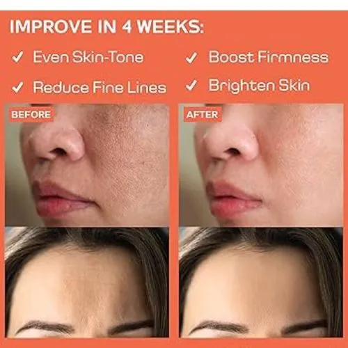 astaxanthin improved skin
